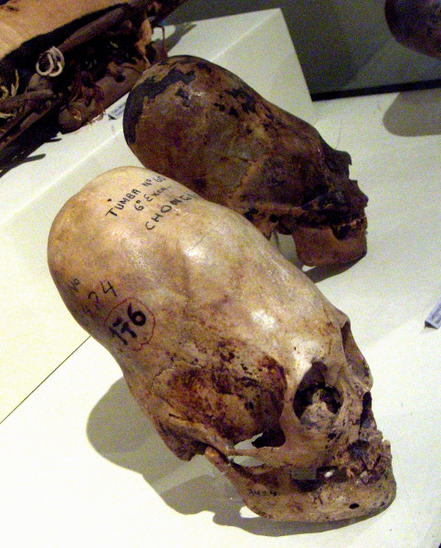 Il cranio deforme numero 176 della tomba 60, conservato presso il Museo Regionale di Ica (Perù)